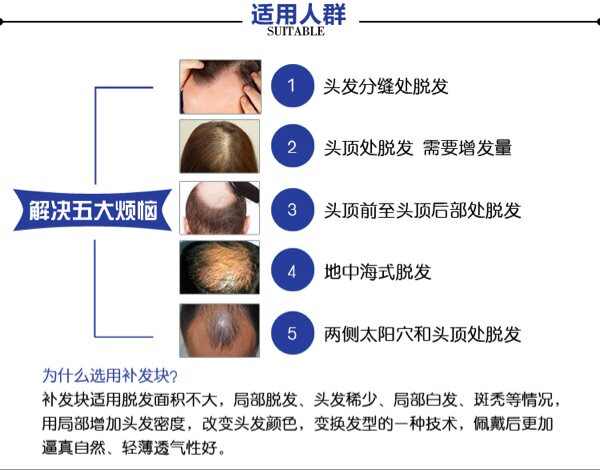 Extension mèches - Ref 225131 Image 5