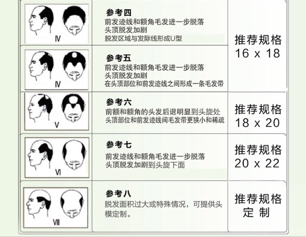 Extension cheveux - Ref 223946 Image 17