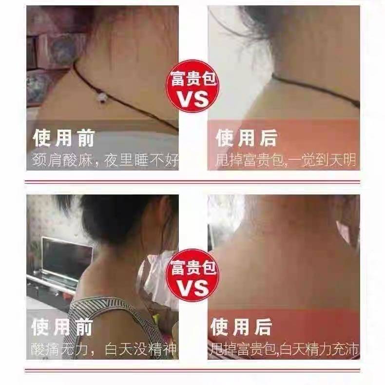 Red Ribiao Ning Su Mu Bing Ning Hongmeng Ning shoulder neck rich bag paste six-pin standard Ning