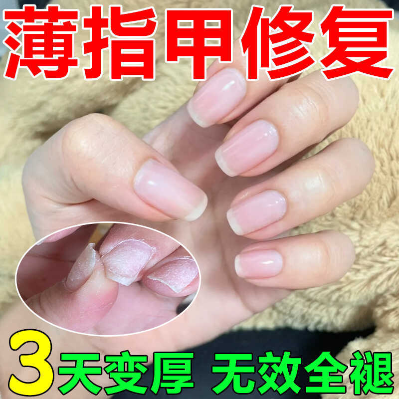 Nail Thinning and Softness Repair Solution, Damaged Nail Regeneration, Nail Care Oil, Nourishing Nail Bed, Preventing Breakage, Thickening, Hardening, Nourishing Oil