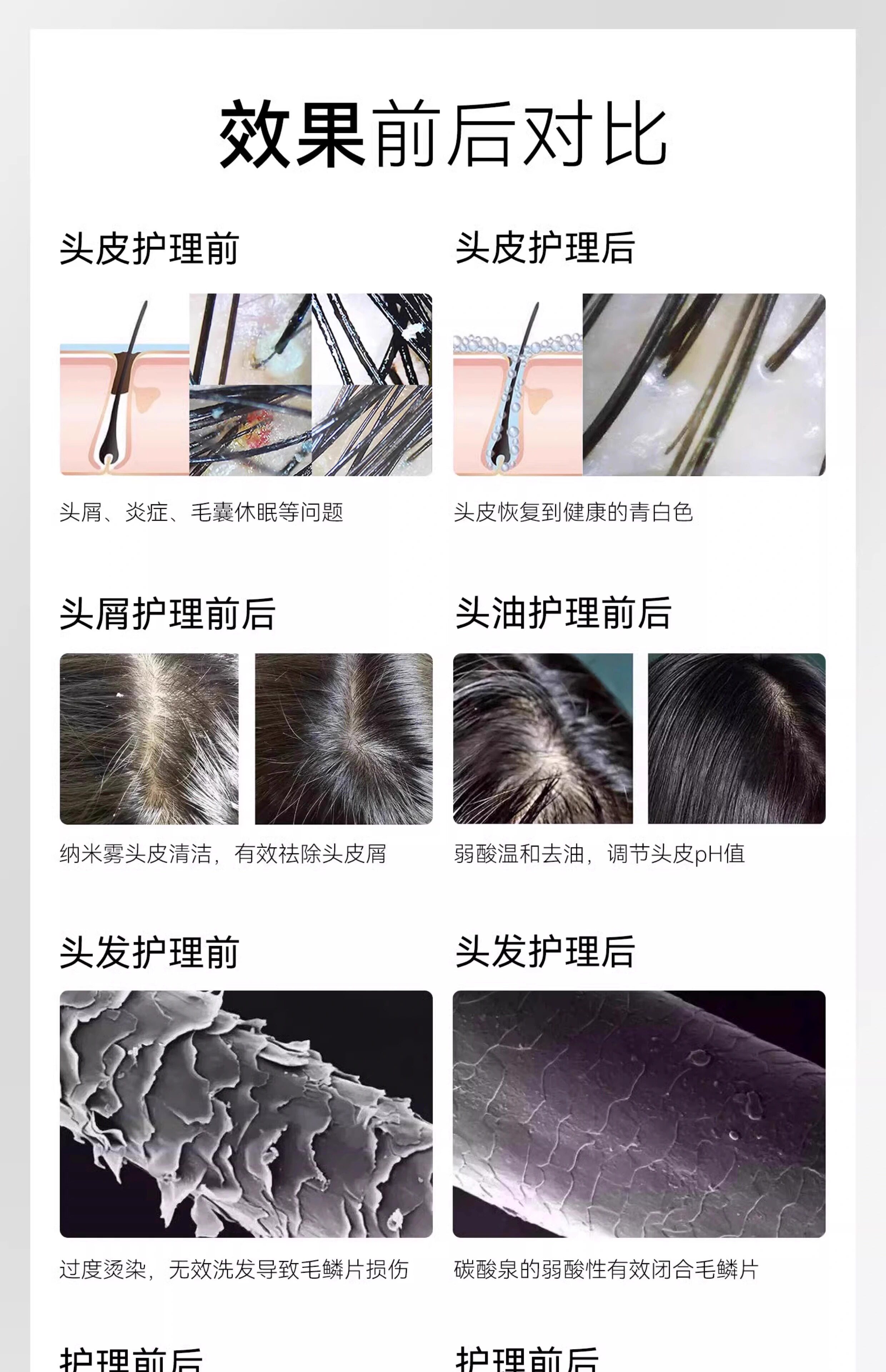 Машина спа 碳酸泉头皮净化仪头皮卸妆碳酸泉二合一设备 3