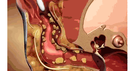 4.gif