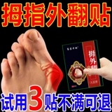Qianjia Laopu вальгусная штукатурка большой стопы, вальгусная деформация большого пальца стопы, деформация большого пальца стопы, горячий компресс, прижигающий пластырь