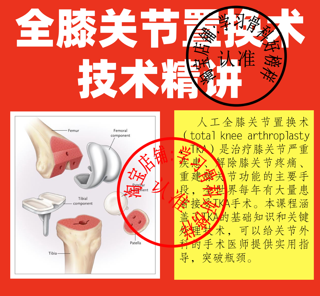 2020 Ortho Self Study Film Tutorial Clinical Application Artificial Total Knee Replacement Training Technical Explanation
