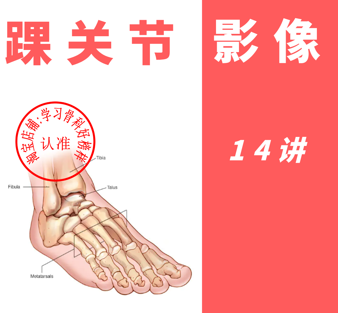 2021 Ankle Architecture Orthopaedic Video Nuclear Magnetic CTX Radiological Tutorial Training in MRI