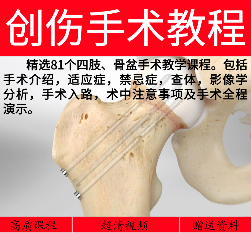 2020 Orthopedics Self Study Film Tutorial Surgery Teaching Clinical Application AO Tutorial Joint Crest Post Trauma Surgery