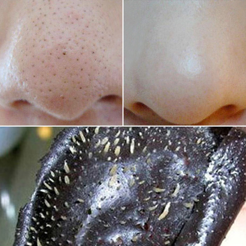 去黑头收缩毛孔套装吸黑头导出液祛去粉刺鼻膜贴撕拉式面膜男女