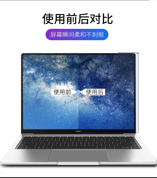 Huawei matebook14 13 máy tính xách tay x màn hình chuyên nghiệp e vinh quang ma thuật phim cường lực d máy tính chống xanh bảo vệ phim 15,6 inch 2019 phần rồng sắc nét của bảo vệ bức xạ - Phụ kiện máy tính xách tay miếng dán laptop