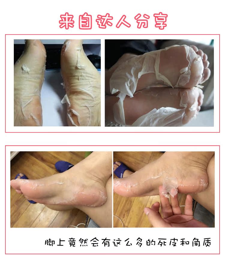 Nhật bản MiiMeow Mi một chân bộ phim chăm sóc bàn chân để da chết cũ sừng chân mặt nạ làm trắng và giữ ẩm tẩy da chết gót chân