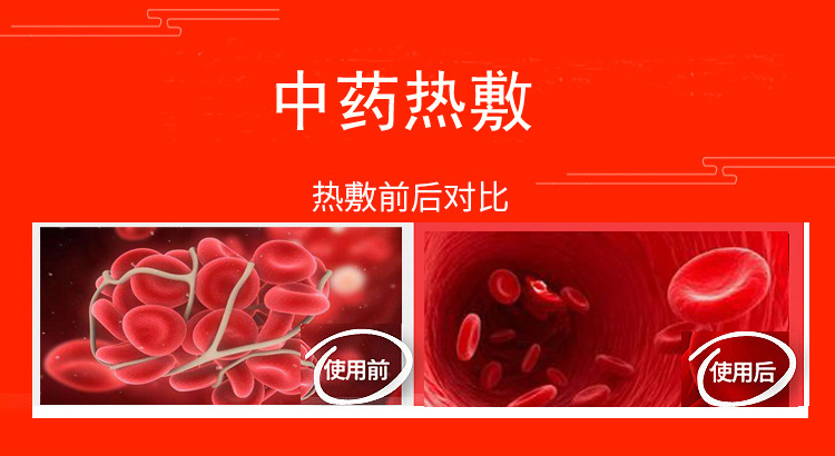 Shuntiande cổ tử cung gối sửa chữa cổ tử cung cổ tử cung đặc biệt cổ gối người lớn vật lý trị liệu kéo điện sưởi ấm điều trị Jingjiao y học Trung Quốc