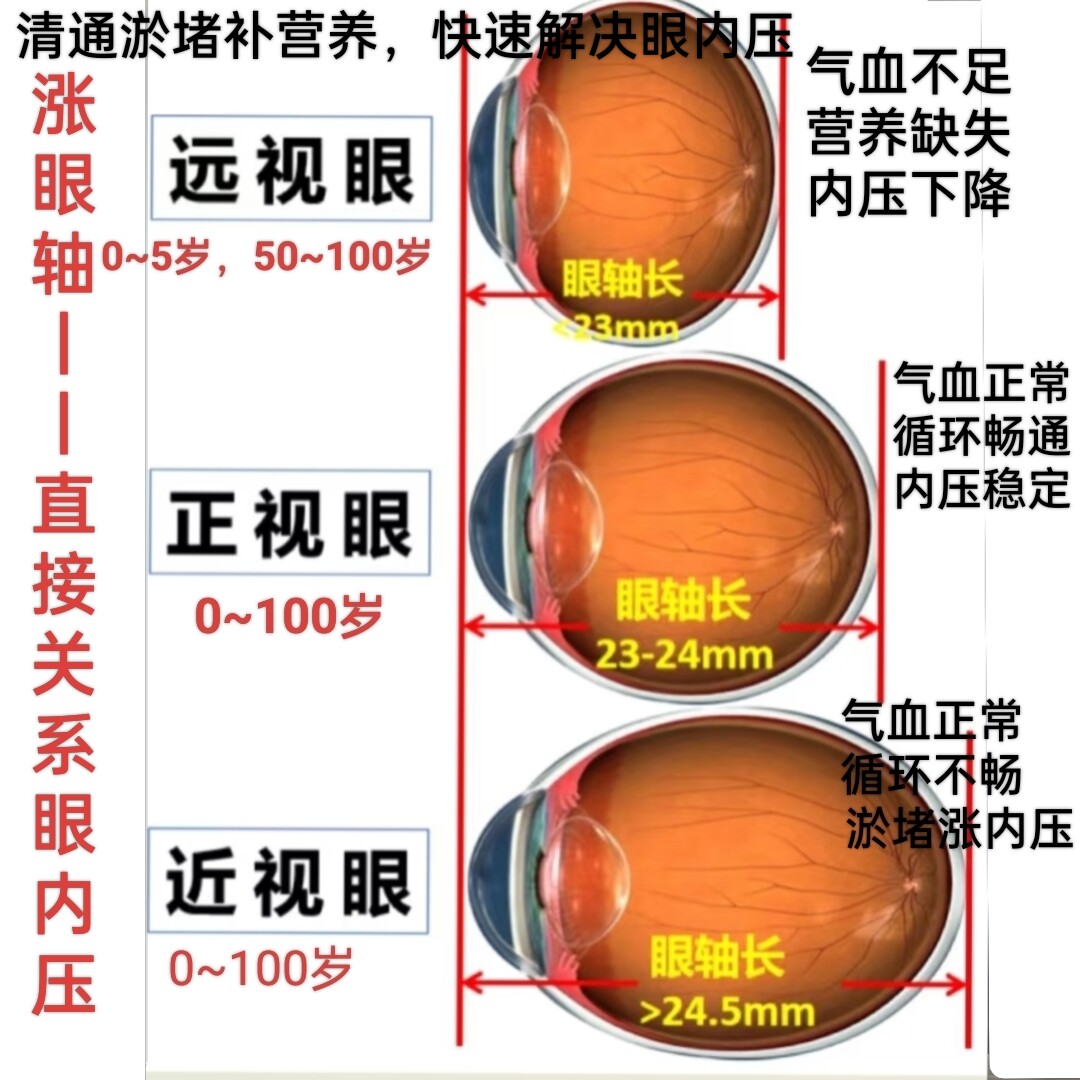 视百年眼部清新套装：科学护眼，精准改善眼部微生态_眼部护理套装_淘宝