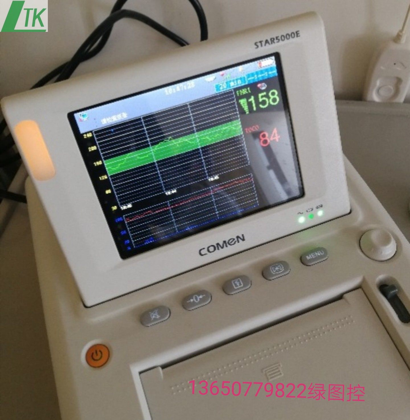 COMEN Fetal Monitor copy paper STAR5000E COMEN Fetal monitor paper 112mm*100mm-150P
