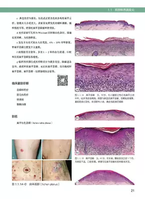 现货实用皮肤组织病理学结构模式分类病理临床图谱对应高天文 王雷 廖文俊主编人民卫生出版社