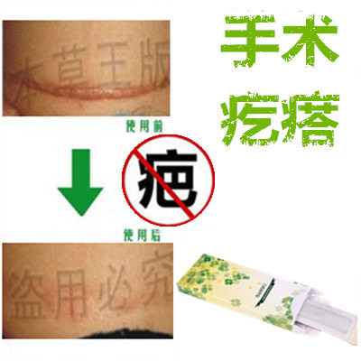 Removing the surgical proliferative scars to break the palace prolific scars Inspiring to dilute the stitches melanin black pigment reflux marks