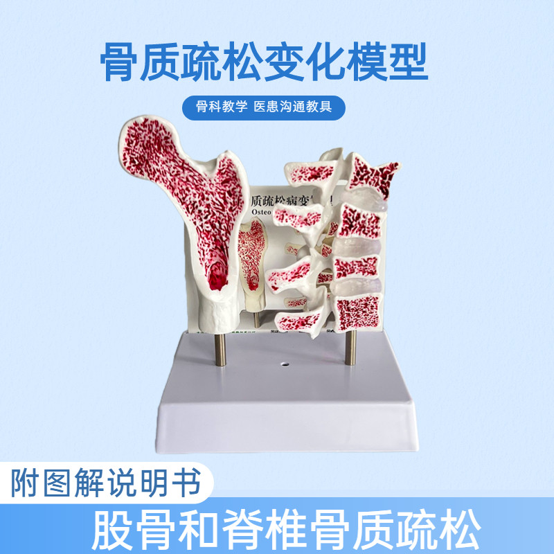人体骨骼股骨骨质疏松解剖模型腿骨解剖面脊柱切面标本病变腰椎模