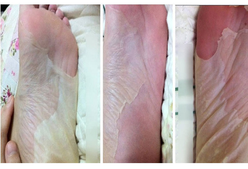 Lấy 1 sợi tóc 2 chân cho da chết, da già, bong tróc, chân mềm, tẩy tế bào chết, đắp mặt, chống khô, gót chân, chăm sóc chân kem trị nẻ gót chân