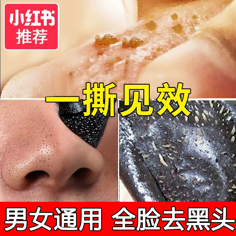 To blackhead acne female tear off mask men's special to remove mites to clean closed mouth wonderful nose stick to suck blackhead artifact full face