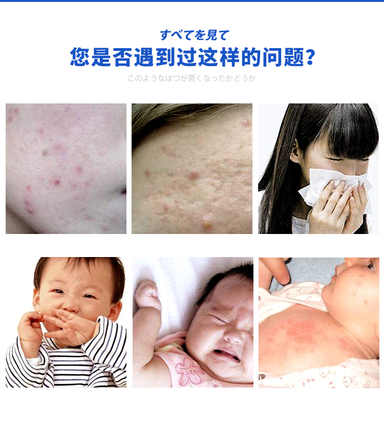 bình xịt muỗi xách tay	 Gia đình Nhật Bản bổ sung mạt xịt phun lên mạt giặt miễn phí chống giết dán - Thuốc diệt côn trùng bình xịt xua đuổi côn trùng
