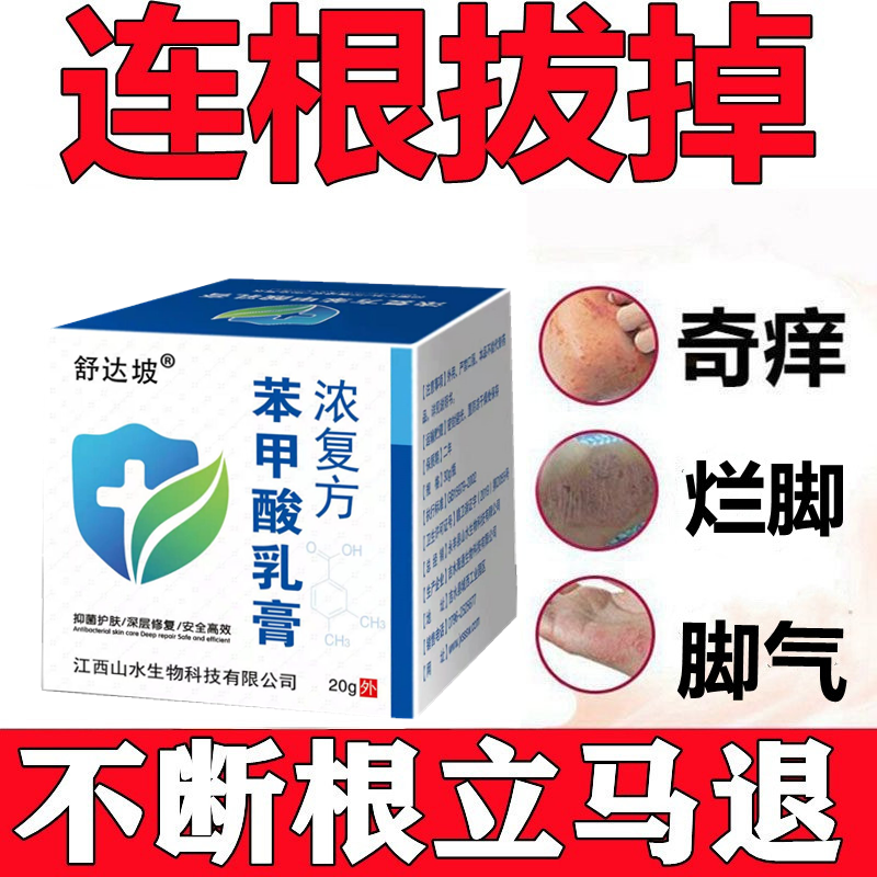 Concentrated compound benzoic acid exfoliating tinea capitis athlete's foot exfoliating ointment old skin rotten feet foot peeling foot itching ointment