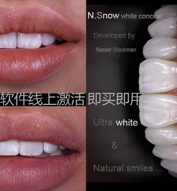 Dental Dentist Beauty Tooth Software Easy Dentist DSD Aesthetic Smile Design Oral Management Software