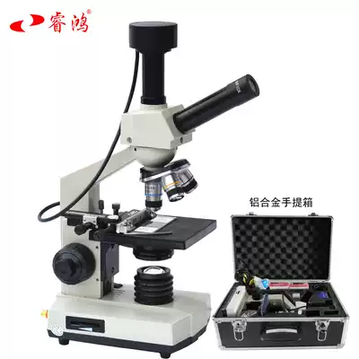 (Ruihong) Digital microscope connected to the computer TV shows a drop of blood testing instrument sub-health to see mites