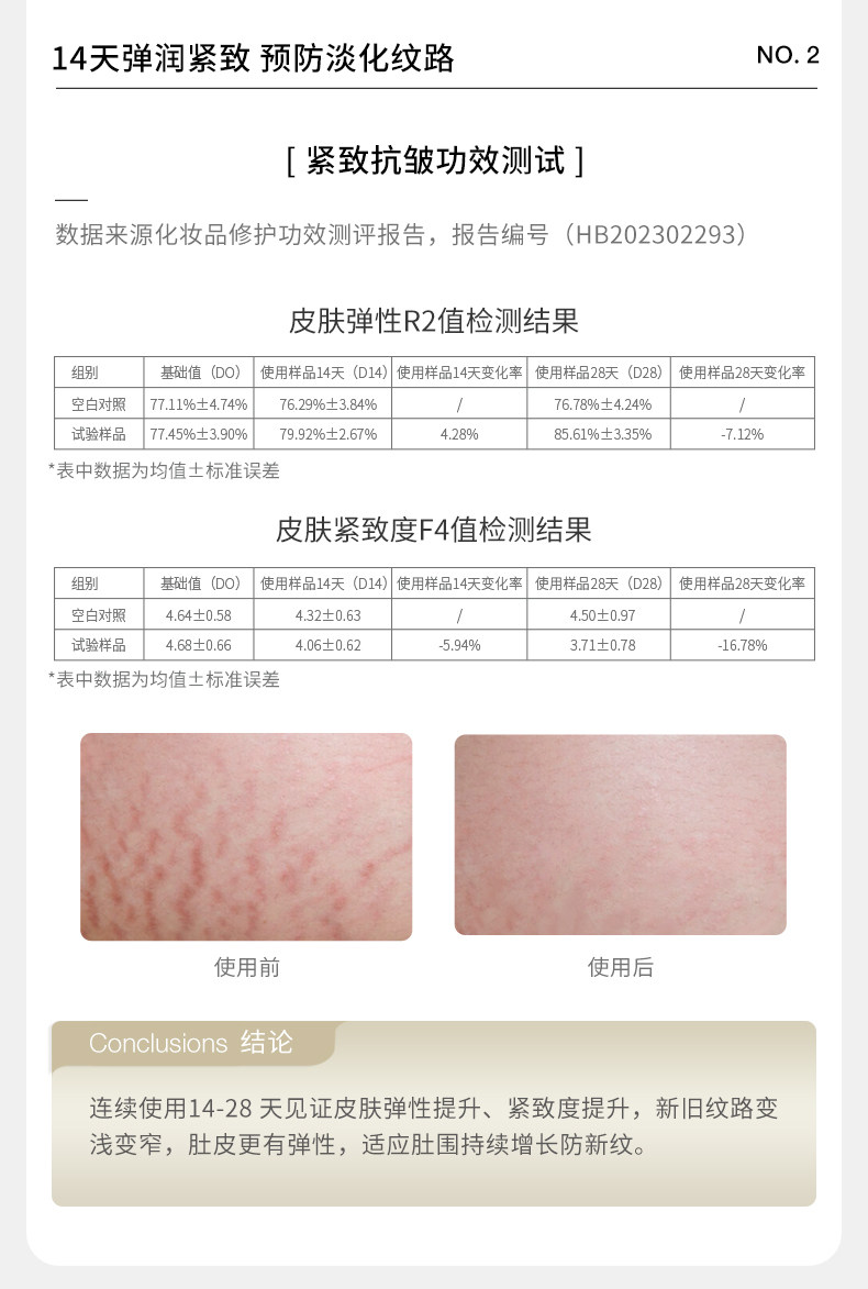 德国嫩芙橄榄妊娠油备孕妇女预防淡化肥胖纹用嫩肤妊辰身体精华油 — 38