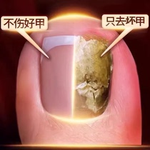Tongrentang hot sale (grow new nails in seven days). One drop of it can turn bad nails into good ones and grow new nails. It can inhibit bacteria without removing nails.