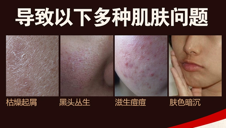 Sữa Facial tẩy tế bào chết kem để da cũ cơ thể giữ ẩm nhẹ nhàng Gel Facial tẩy tế bào chết chà