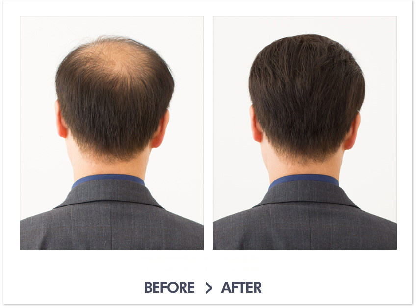 Extension cheveux - Ref 217174 Image 29