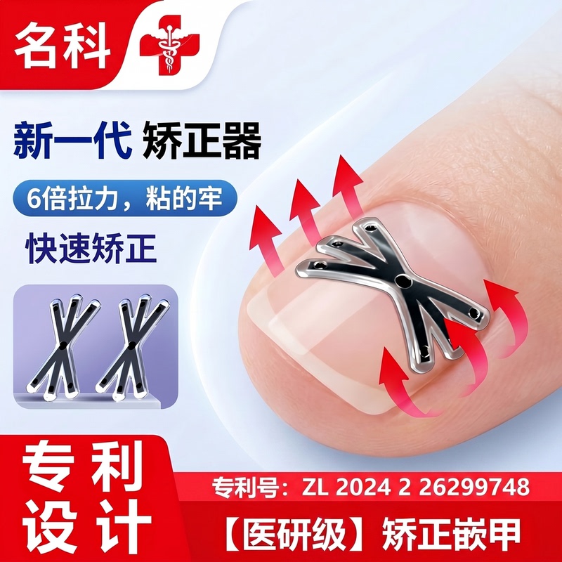 Mingke Ingrown Toenail Corrector Patch for Inflamed Ingrown Nails, Adjusting and Shaping of Ingrown Toenails That Grow into the Flesh Mingke Ingrown Toenail Corrector Patch for Inflamed Ingrown Nails, Adjusting and Shaping of Ingrown Toenails That Grow into the Flesh