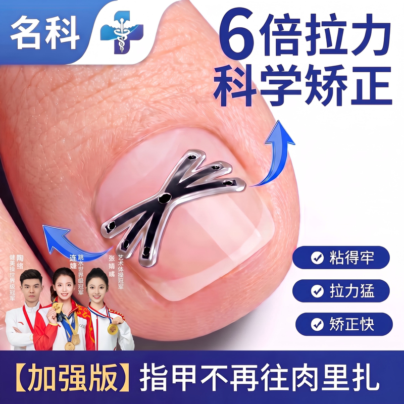 Mingke Ingrown Toenail Correction Device, Nail Patch for Inflamed Ingrown Toenails, Adjusts and Shapes the Nail Shape Mingke Ingrown Toenail Correction Device, Nail Patch for Inflamed Ingrown Toenails, Adjusts and Shapes the Nail Shape