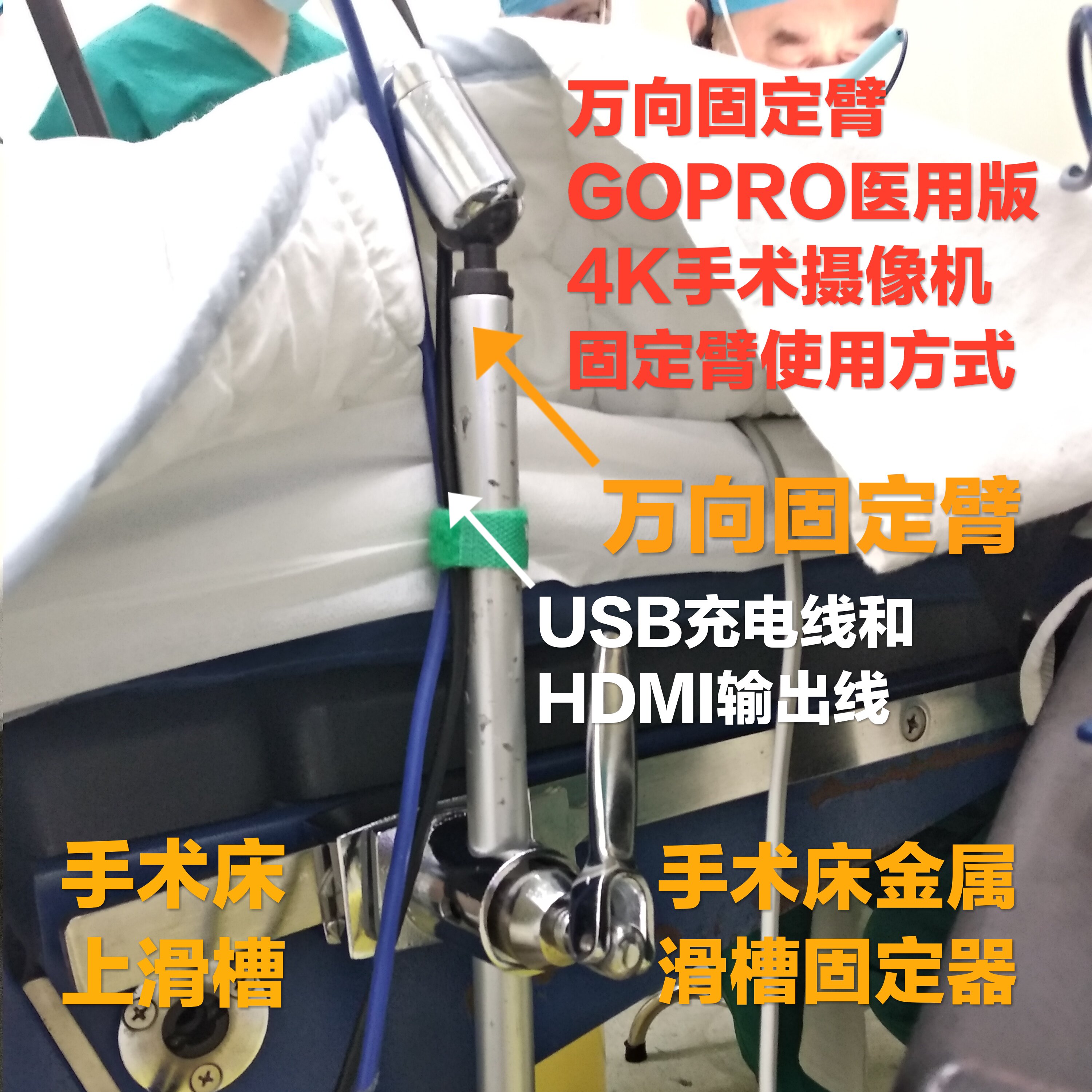 Surgical camera system Universal fixed arm 4K live broadcast Small surgery field angle camera