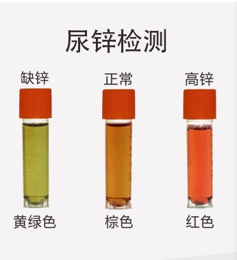 Trace element detection Urine zinc Urinary calcium test for infants and young children, adults, middle-aged and elderly pregnant women, household nutrition test