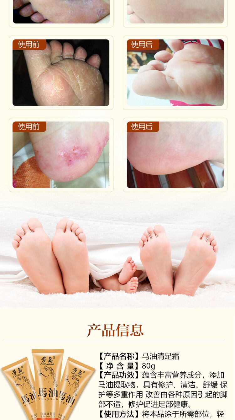 [2 tặng 1] Kem dưỡng da chân ngựa sạch, ngứa, chống khô, kem chăm sóc chân, 80ml chính hãng, ngứa, tác dụng nhanh thuốc bôi nứt gót chân