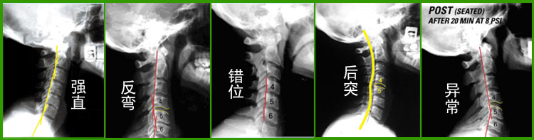 Gỗ vui vẻ sức khỏe sửa chữa cổ tử cung cong chống cung mạnh mẽ thẳng cổ gối tự giúp máy kéo vòng gối gỗ