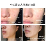 Восстанавливающая эссенция, сыворотка, образец среднего размера, пробник, 15 мл