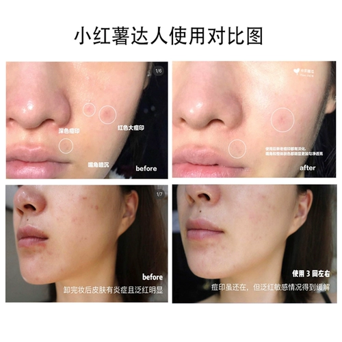 Восстанавливающая эссенция, сыворотка, образец среднего размера, пробник, 15 мл