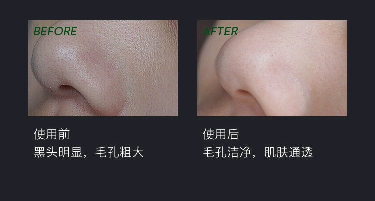 Big Jia Xinlan Frozen Film Cleansing Mask 225g City Wild Doctor Cleansing Blackhead Pore sample Trial 35g Chính hãng