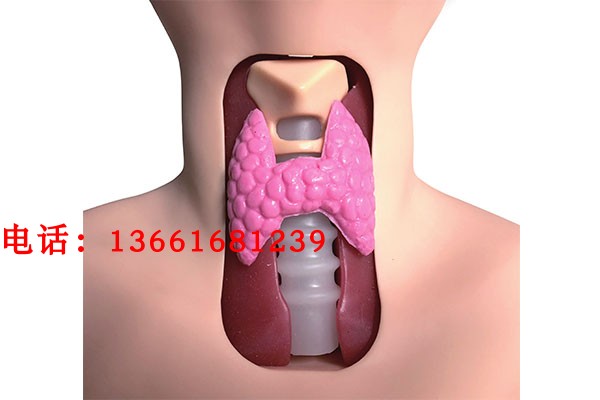 甲状腺检查模型 甲状腺结节检查模型