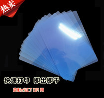 Inkjet blue medical film blue based dry radiology printing film dental fracture X-ray film DR CR CT