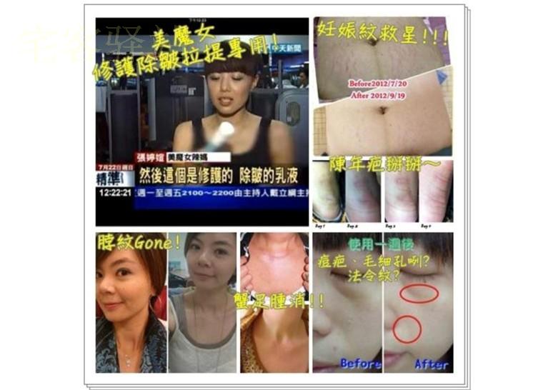 Tại chỗ Hoa Kỳ Mei'an Pingtai Hiển thị Pentaxyl tẩy kem nếp nhăn Botox dưỡng ẩm innisfree