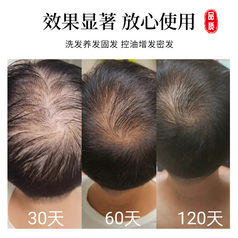 倪海厦古方侧柏叶当归防脱生发皂,天然控油增发密发,告别脱发困扰!-手工皂-淘宝好物网