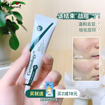 Aqin Kna blue loquat acne cream dredge pores to repair skin faded