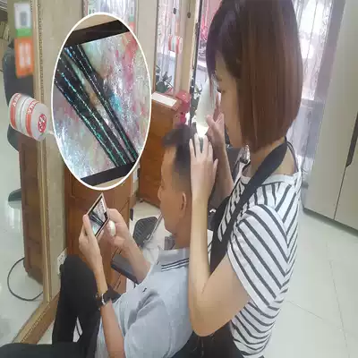 HD Smooth stop frame contrast magnification 500 times electronic head dermatoscope hair pore scalp detector