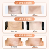 Подтягивающий увлажняющий отбеливающий лечебный крем для шеи, против морщин