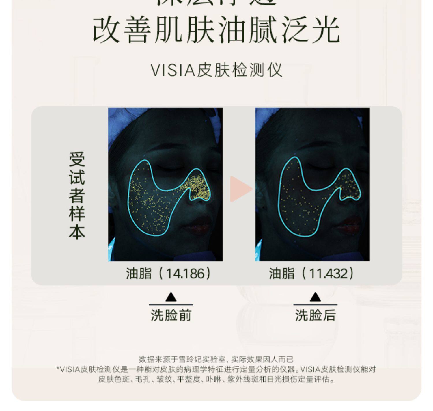 雪玲妃氨基酸洗面奶女敏感肌专用洁面乳控油保湿慕斯男士官方正品