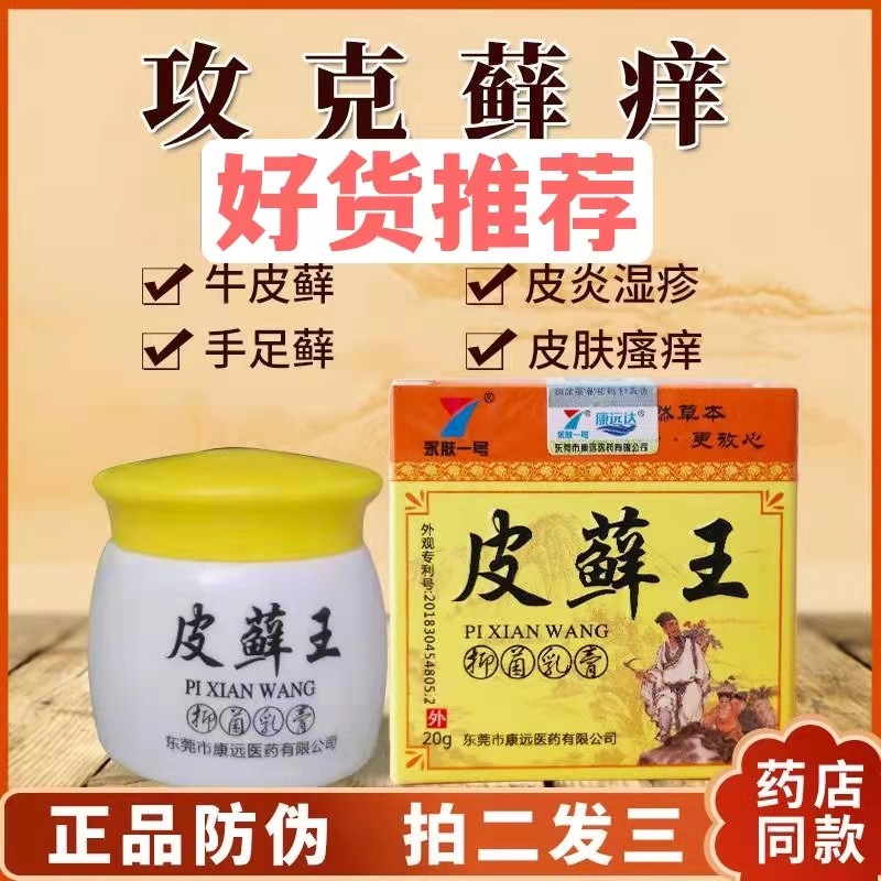 Moss king peeling dry cracked hands with little water in the palm of the hand and fingers medicinal anti-itching ointment hand itch skin rough