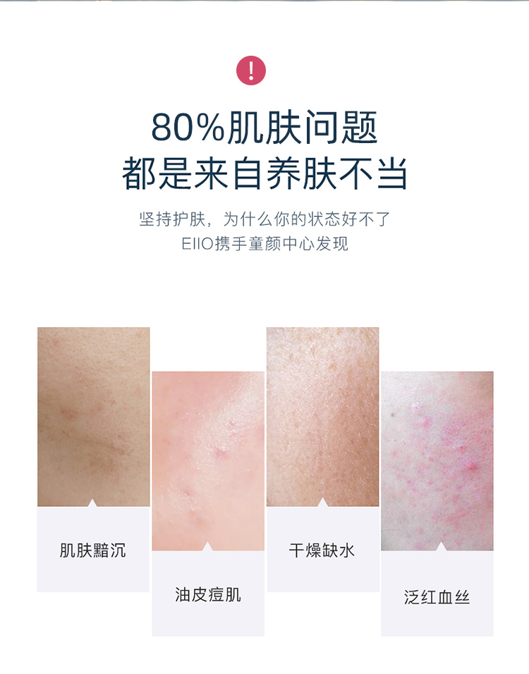 eiio Water Milk Flagship Bộ Sản Phẩm Dưỡng Ẩm Và Dưỡng Ẩm Da Chính Hãng Da Dầu Da Mụn Da Nhạy Cảm Hộp Làm Mới Cơ Học Sinh Viên cetaphil dưỡng ẩm