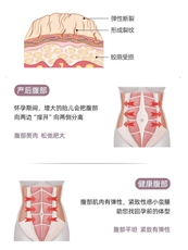 Обработка инструментов после родов 腹直肌分离锻炼神器修复仪产后家用收腹带训练器肚子松弛收紧紧致