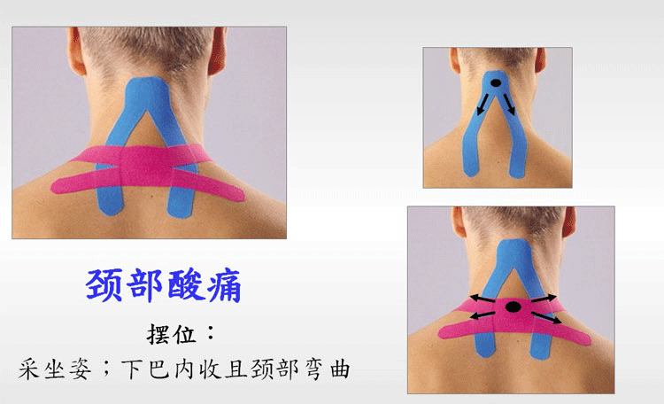 Protection sport - Ref 582440 Image 8